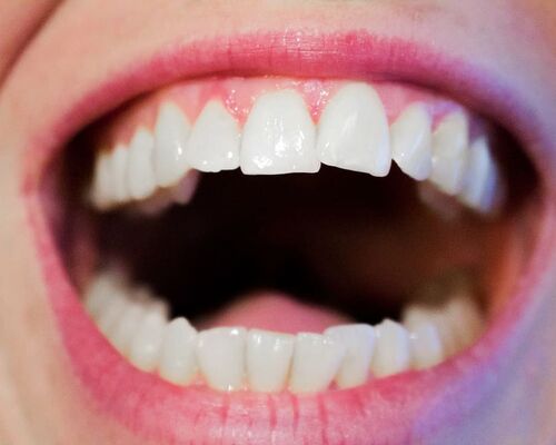 teeth-dentist-dental-mouth2