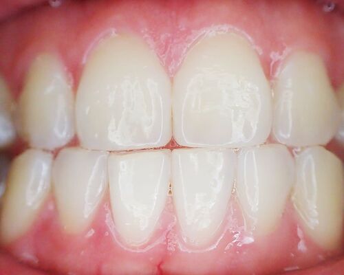teeth-mouth-dental-dentist
