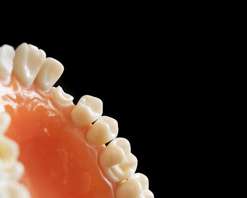 dentist-dentistry-orthodontics-decay