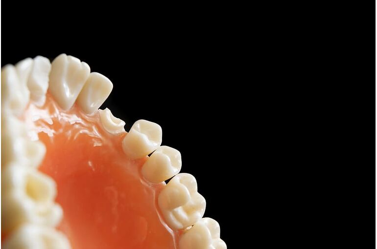 dentist-dentistry-orthodontics-decay