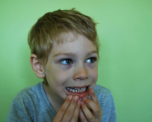 baby-teeth-open-teeth-mouth
