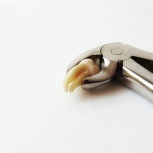 tooth-dentist-molar-wisdom-tooth-tooth-removal-tooth-extraction