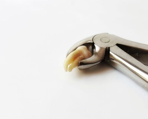 tooth-dentist-molar-wisdom-tooth-tooth-removal-tooth-extraction