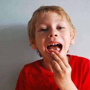 baby-teeth-without-boy-mouth-showing-missing