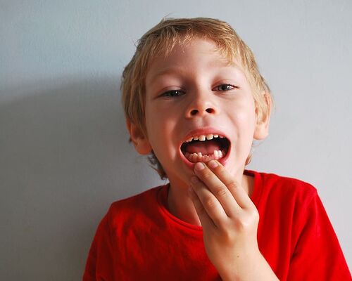 baby-teeth-without-boy-mouth-showing-missing