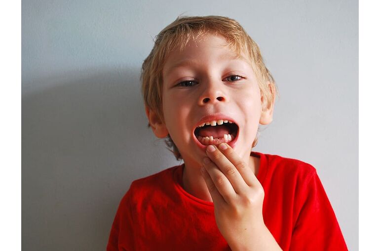 baby-teeth-without-boy-mouth-showing-missing